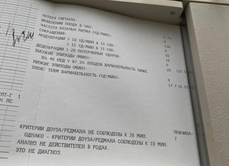 Что значит критерии доуза редмана соблюдены к 10 мин