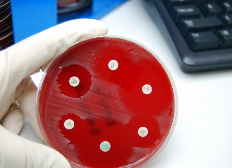 Бак посев на микрофлору и чувствительность к антибиотикам расшифровка