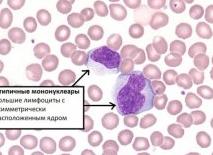 Атипичные мононуклеары в общем анализе крови у ребенка