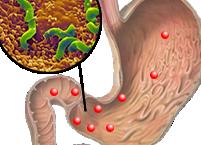 Антитела к хеликобактер