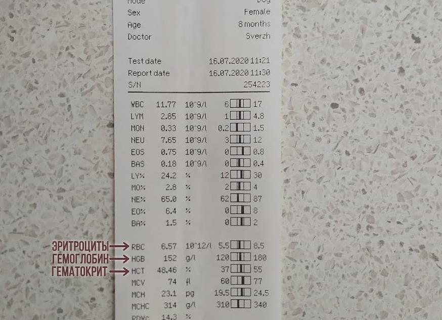 Анализ крови общий гематокрит