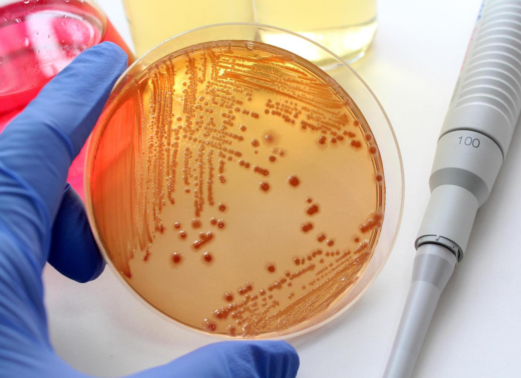 Анализ бак посев что это в гинекологии