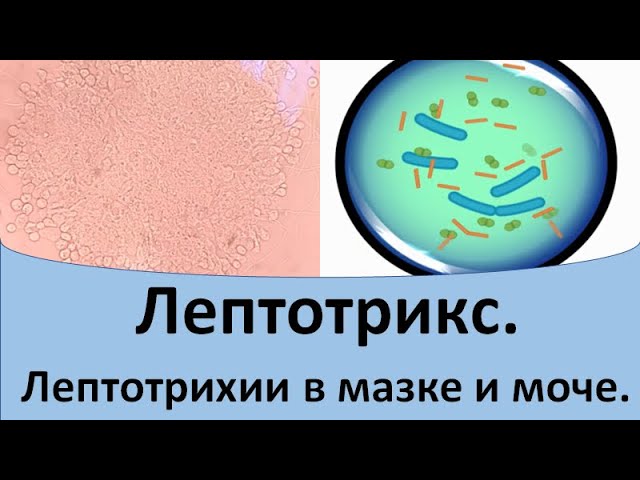 Лептотрикс в мазке