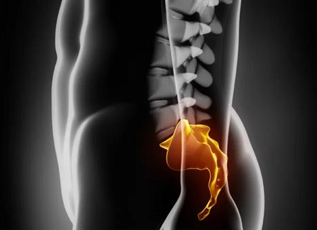 Мрт копчика что показывает