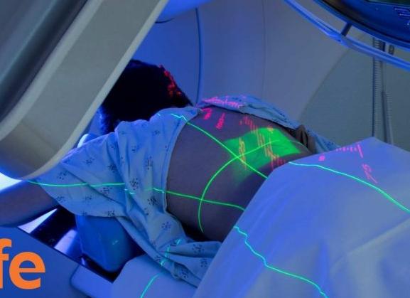 Лучевая терапия что это