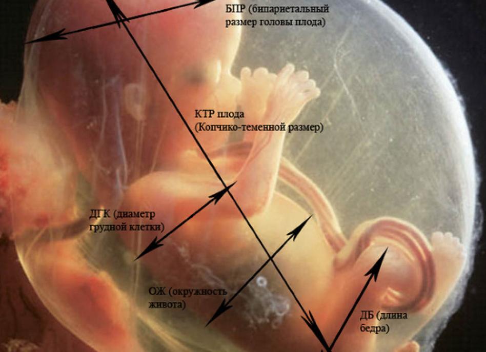 Лобно затылочный размер