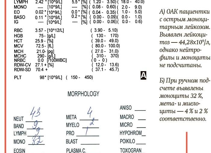Лейкоциты в общем анализе крови