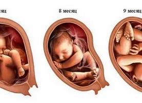 Когда третий скрининг Когда третий скрининг