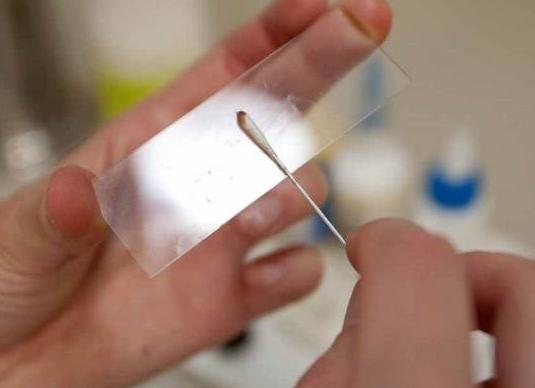 Какой врач делает соскоб на энтеробиоз