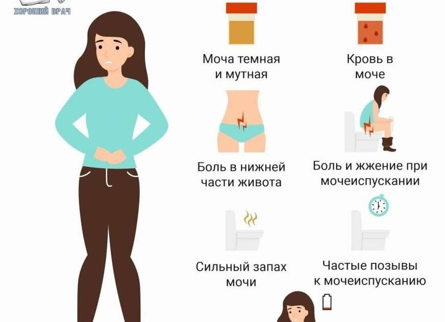 Какие анализы нужно сдать при цистите женщине