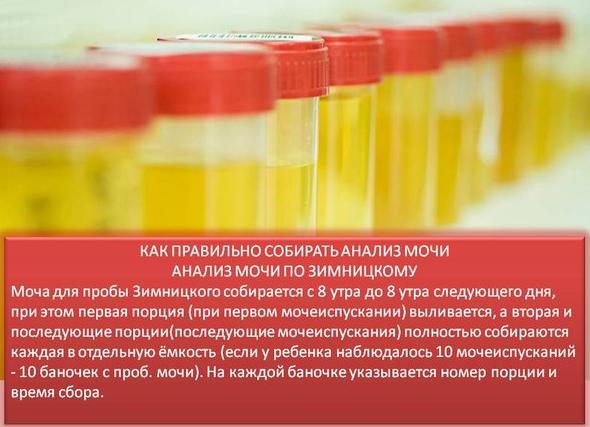 Как правильно собрать мочу по зимницкому