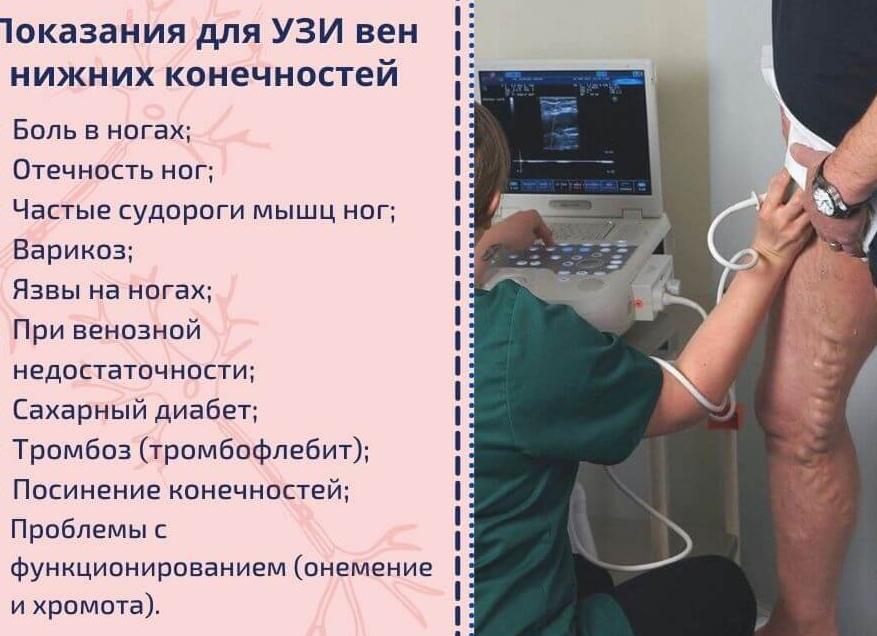 Исследование вен нижних конечностей