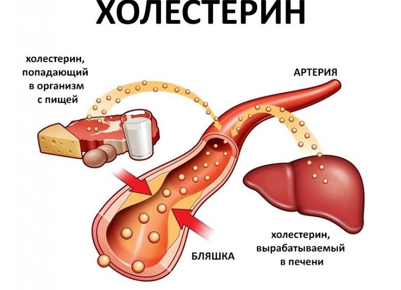 Холестерин что это