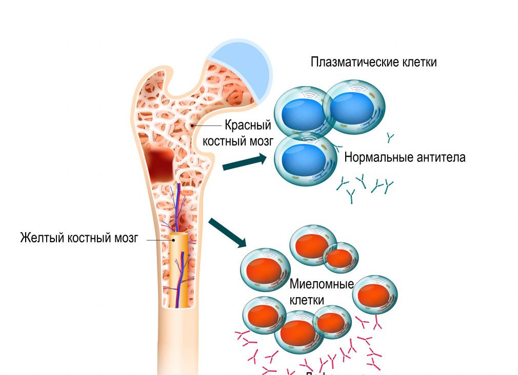 Что такое угнетение костного мозга