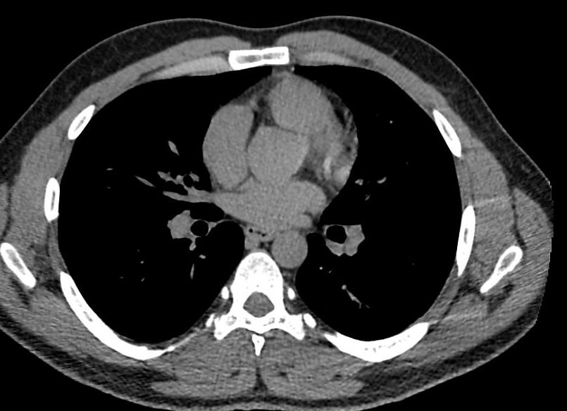 Что такое кт органов средостения