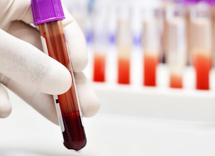 Анализ крови на гемоглобин натощак или нет Анализ крови на гемоглобин натощак или нет