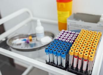 Анализ алт аст билирубин