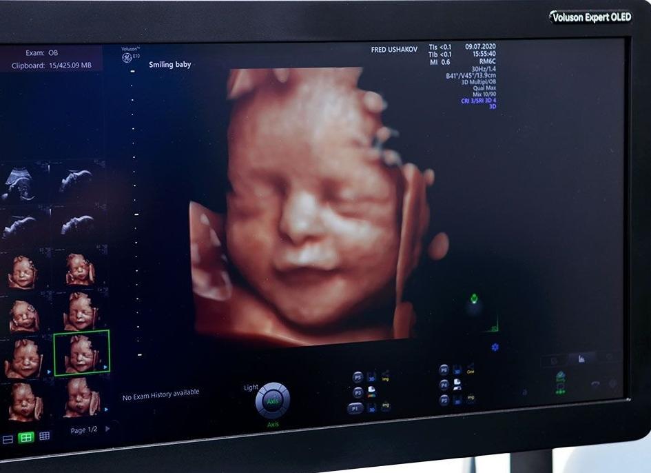 3 скрининг во сколько недель делают