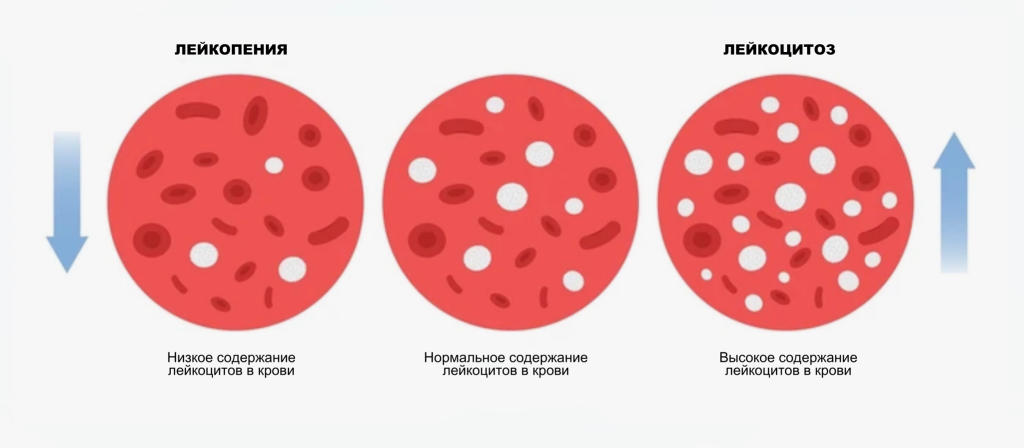 Лейкопения у ребенка