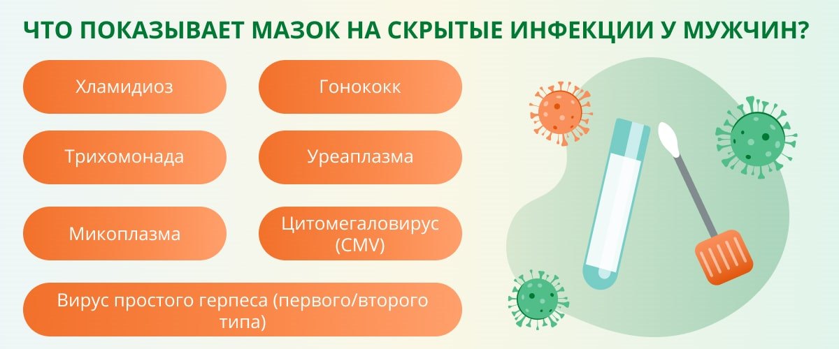 Мазок на флору что показывает у мужчин