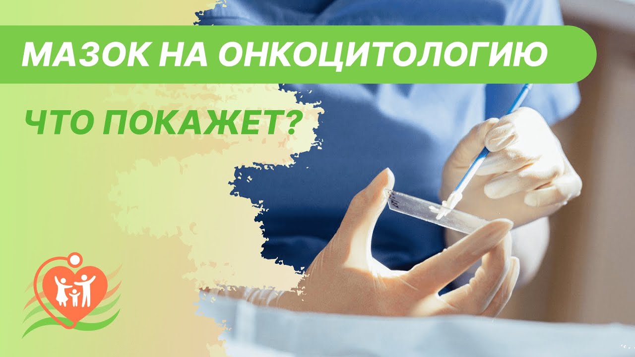 Мазок на раковые клетки гинекология