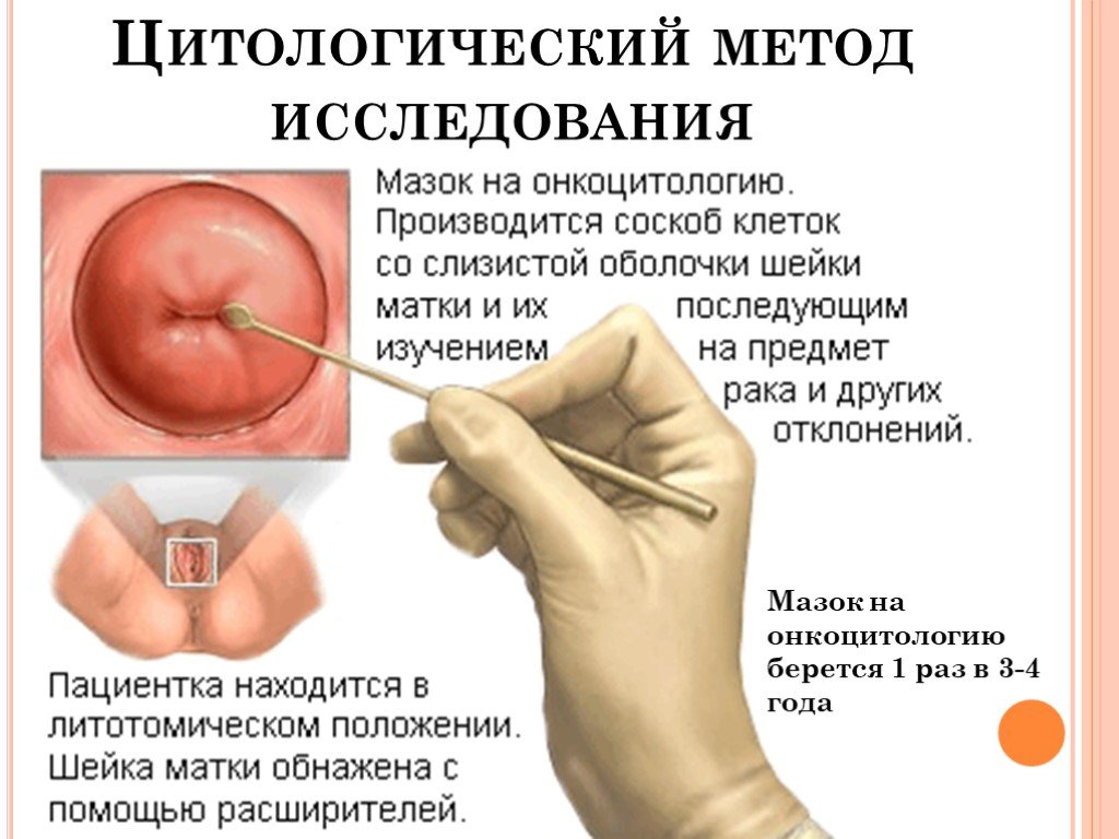 Мазок на цитологию что