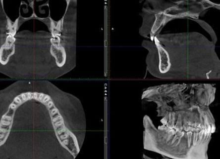 Мрт в стоматологии