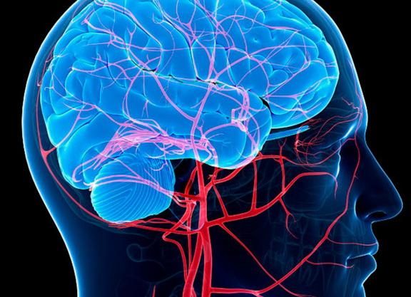 Мрт сосудов шеи и головного мозга