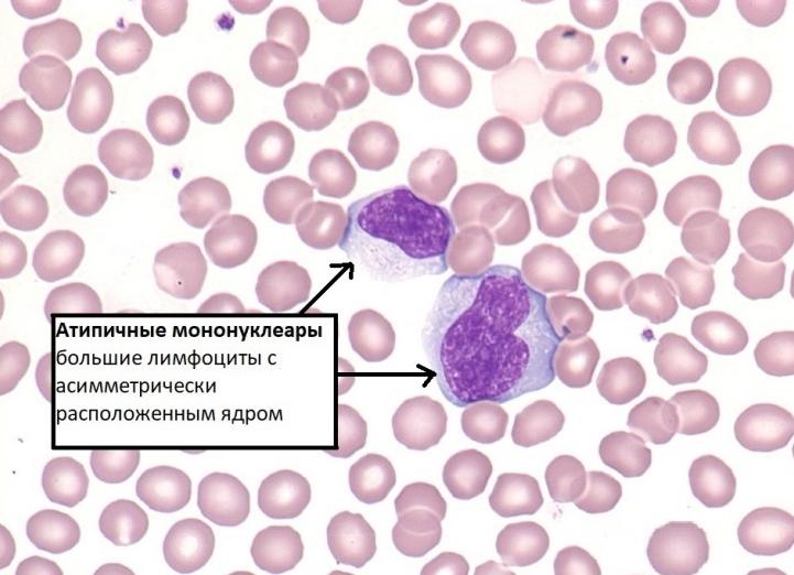 Мононуклеары в крови
