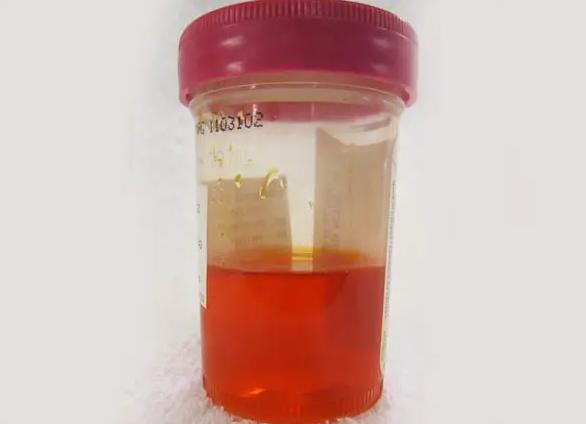 Моча от свеклы