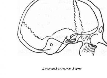 Мезоцефалическая форма черепа Мезоцефалическая форма черепа