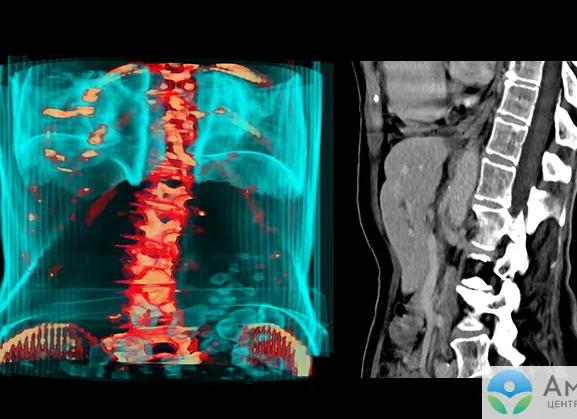 Кт с контрастом