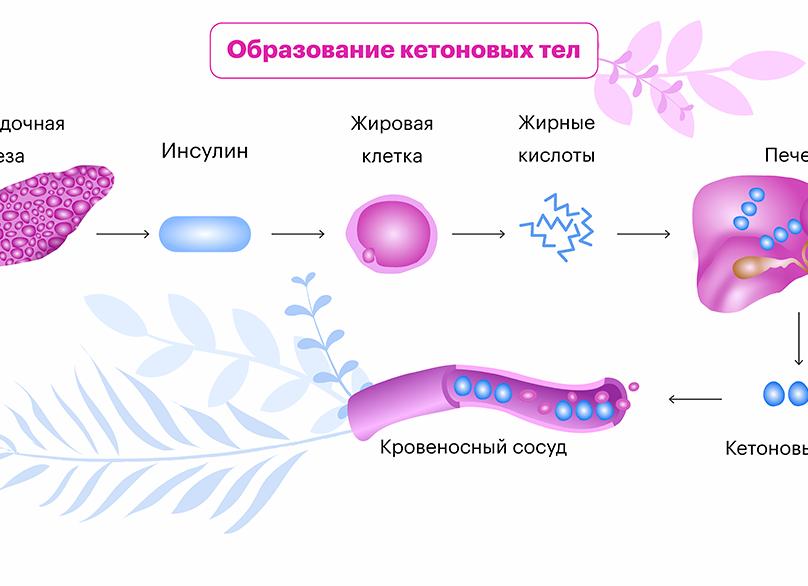 Кетон в моче причины