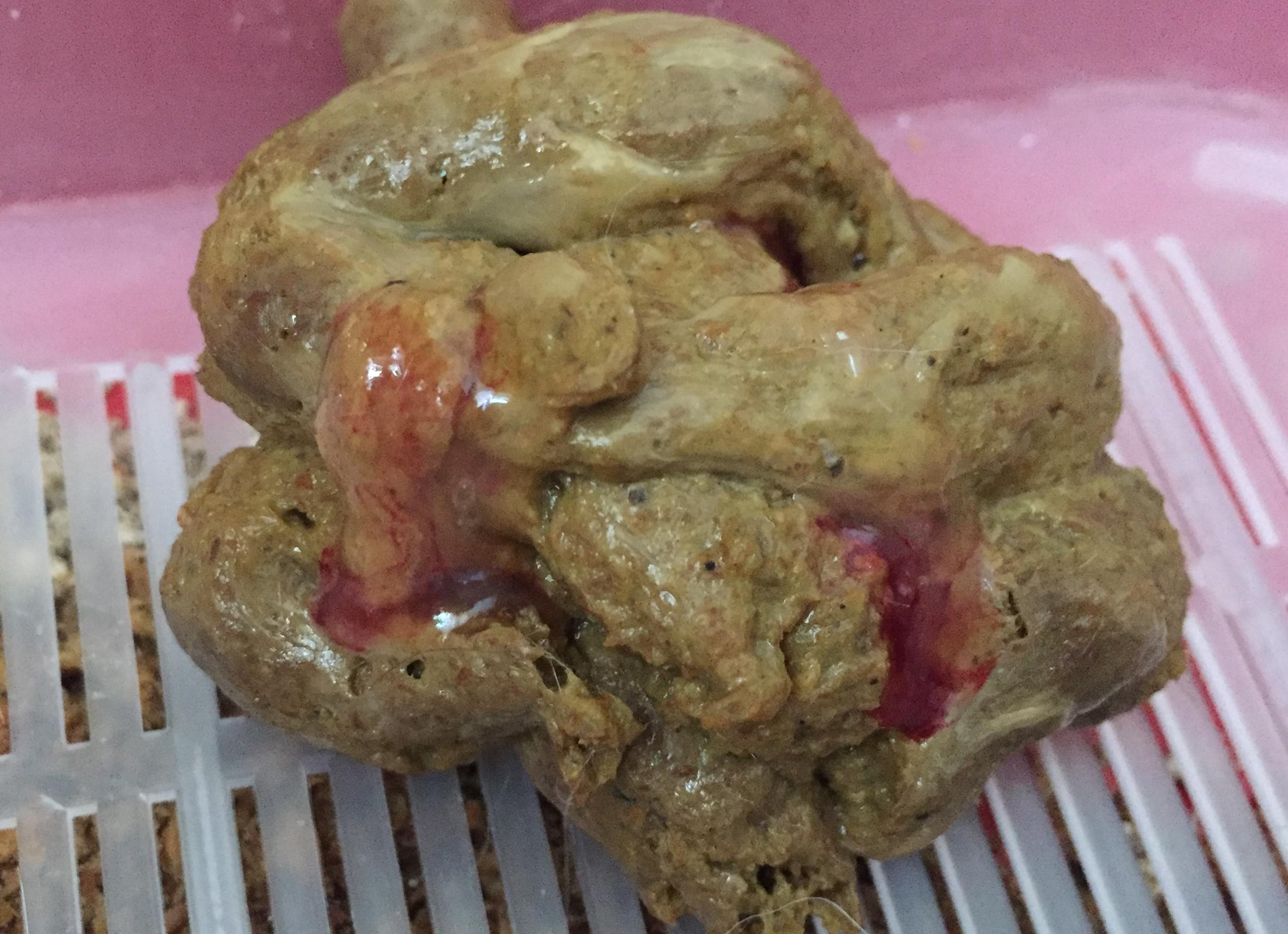 Кал с примесью крови что это может быть