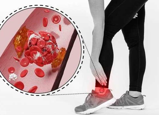 Как понизить гемоглобин