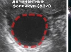 Как по узи определить овуляцию