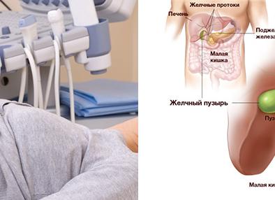 Как готовиться к узи желчного пузыря