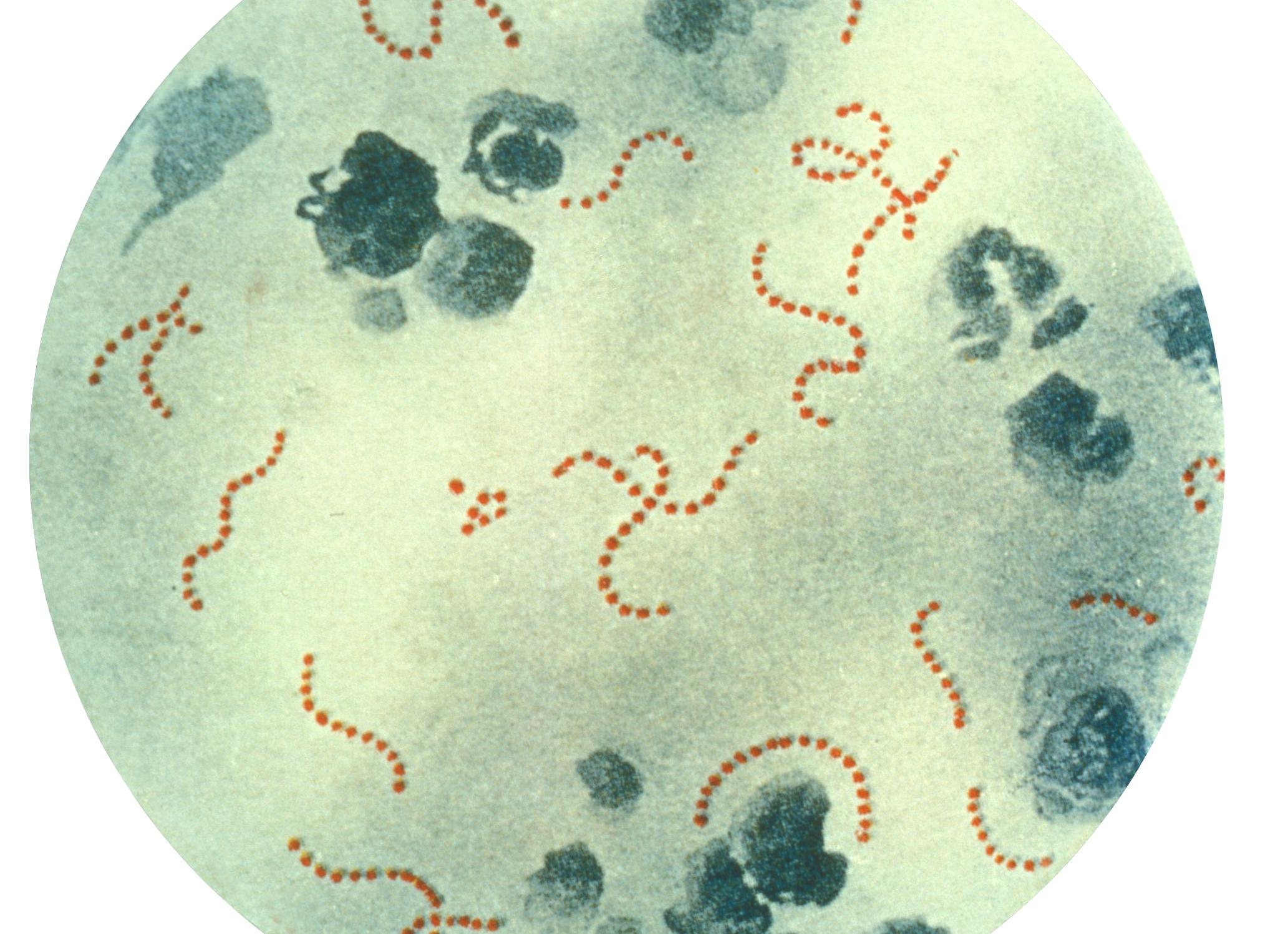 Гемолитический стрептококк группы а