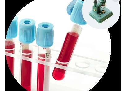 Где сдать общий анализ крови ребенку