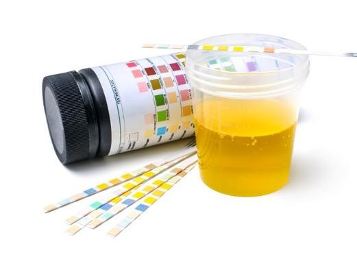 Альбуминурия что такое Альбуминурия что такое