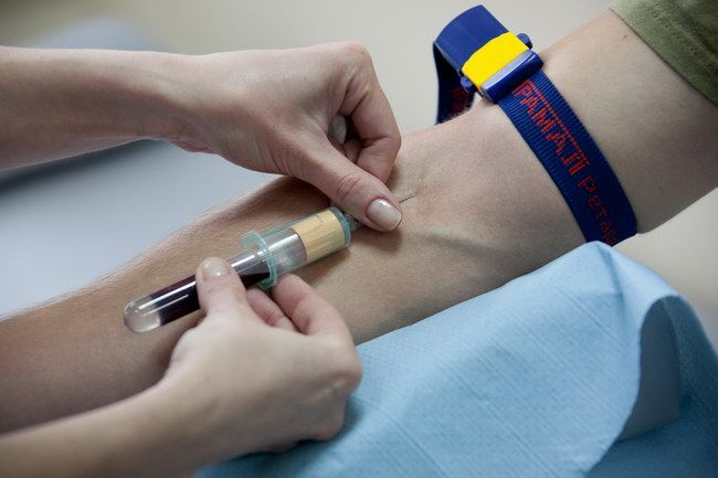 Анализ крови на рв что это такое