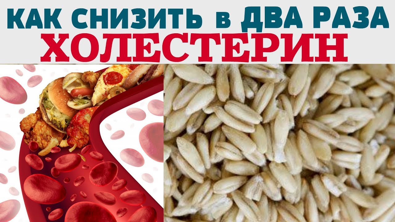 Как снизить холестерин в крови медикаментами