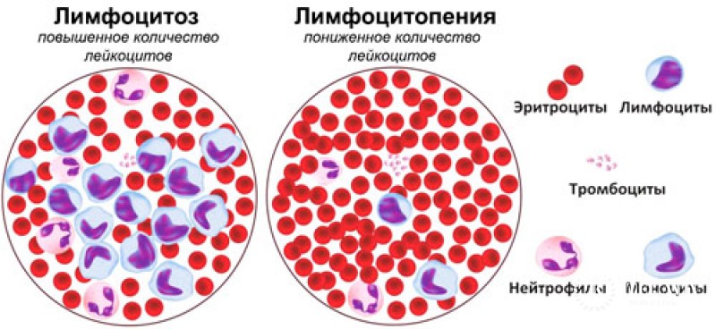 Лимфоциты как понизить