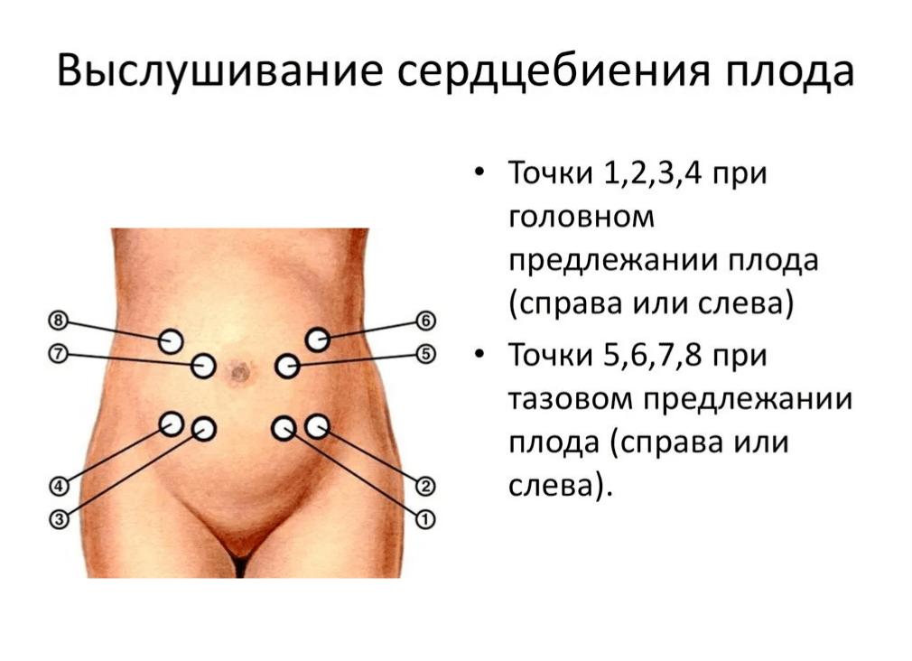 Когда слышно сердцебиение плода через живот