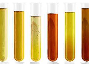 Как сдать мочу во время месячных