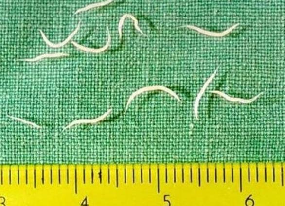 Энтеробиоз у детей фото