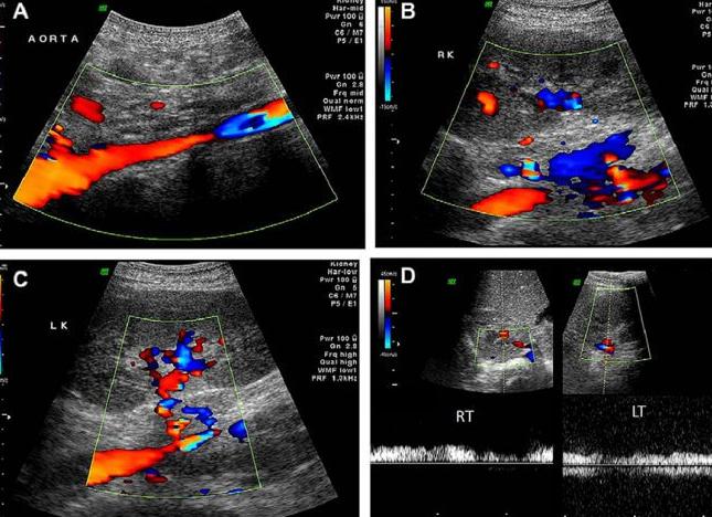 Допплеровское исследование это