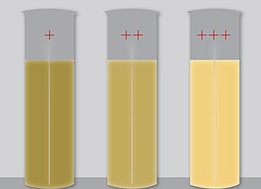 Цвет спермы нормальный