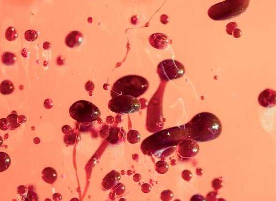 Чем опасна разжиженная кровь