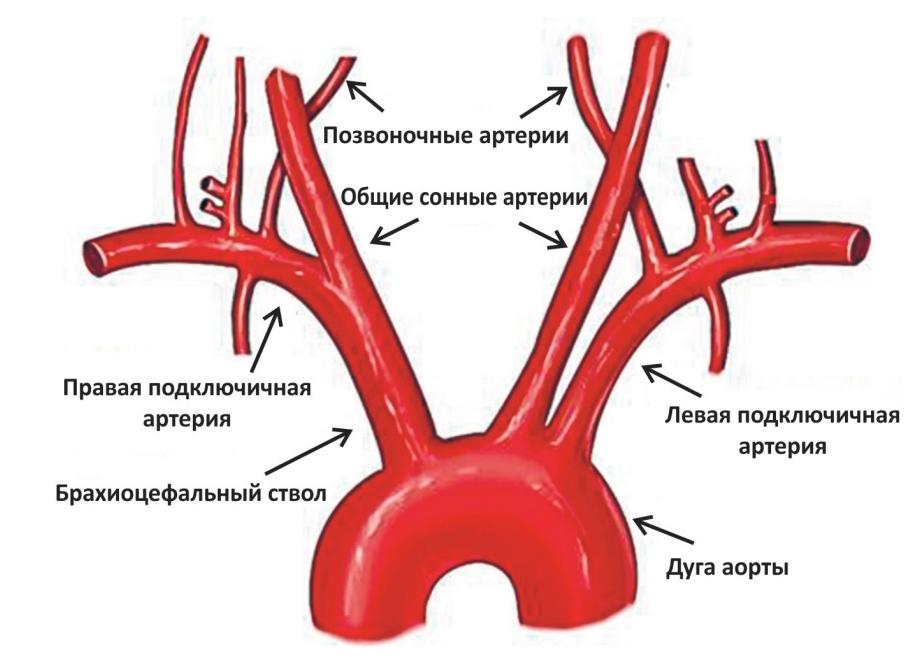 Брахиоцефальные сосуды что это такое
